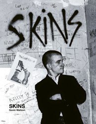 <B>Skins</B> <BR>Gavin Watson